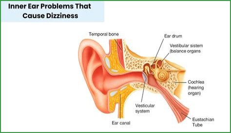 Can bulimia cause ear problems