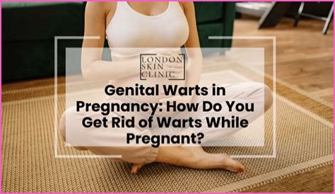 Can genital warts appear during pregnancy?